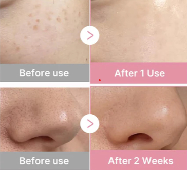 Zenthra Prime™ Skin Repair + Glow Activation Serum