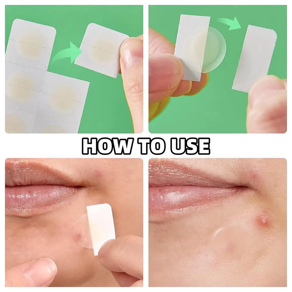 Microneedle Acne Patch Waterproof Smooth Concealer Invisible Breathable Patch