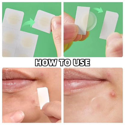 Microneedle Acne Patch Waterproof Smooth Concealer Invisible Breathable Patch
