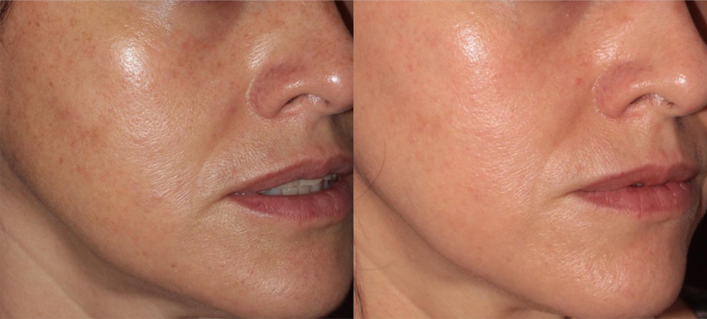 Zenthra Prime™ Skin Repair + Glow Activation Serum