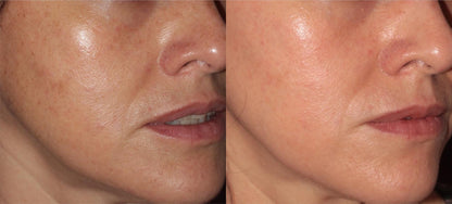 Zenthra Prime™ Skin Repair + Glow Activation Serum