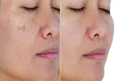Zenthra Prime™ Skin Repair + Glow Activation Serum